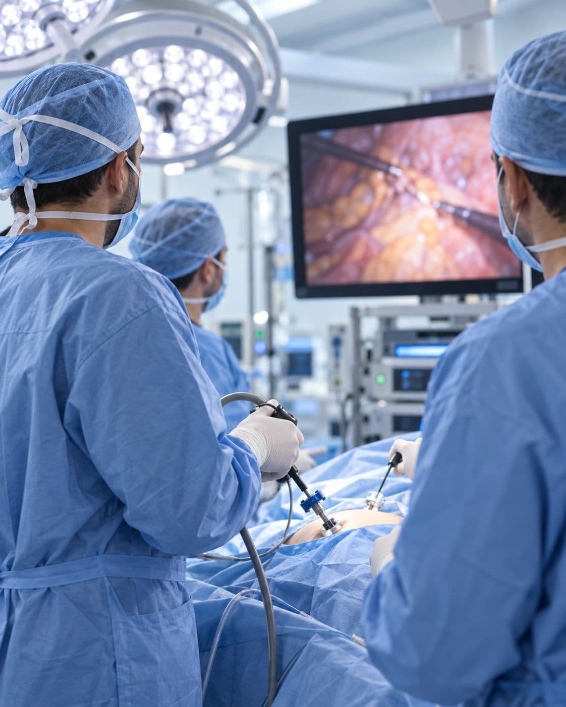 Equipo quirúrgico con bata azul operando por laparoscopia frente a un monitor en el quirófano